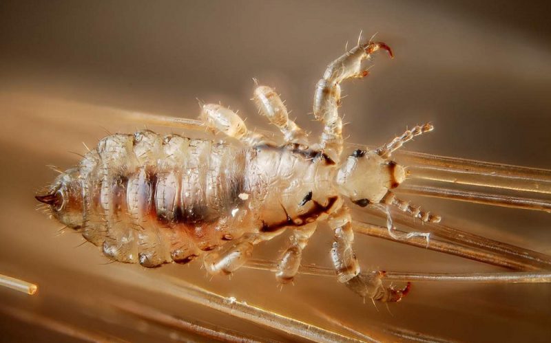 вошь на голове