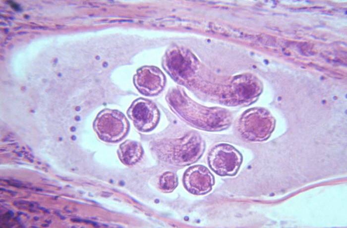 Трихинелла