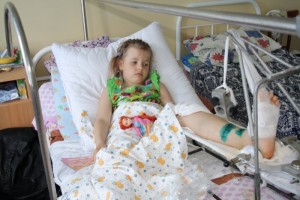 Реабилитация ребенка после перелома