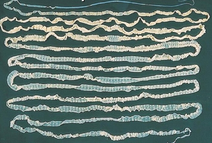 Бычий цепень строение