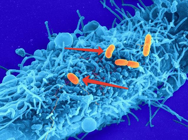возбудитель дезентерии