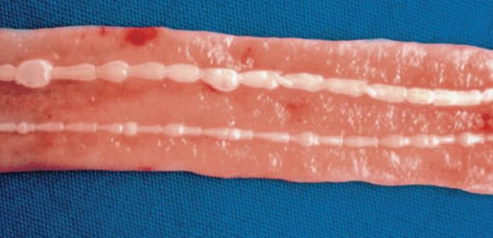 глистная инвазия