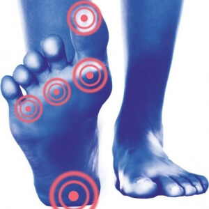 Лечение мозолей на ногах с пластырем Юкан