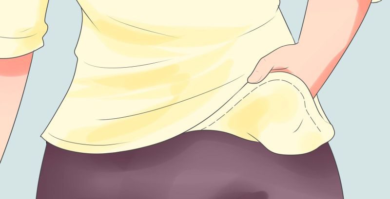 платяные вши