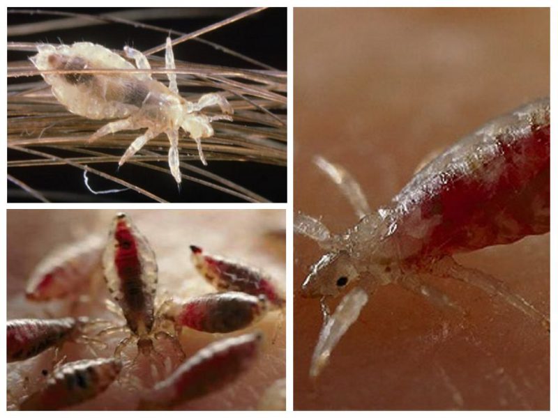 Вши, обитающие на людях