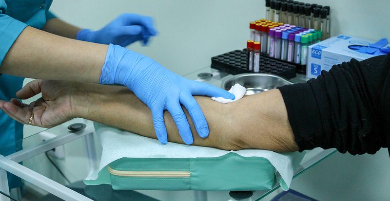 кровь из вены