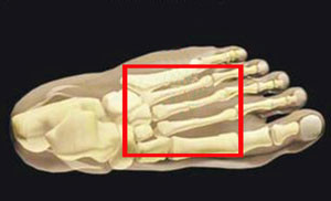 Кости стопы Болевые ощущения появляются в средней части стопы