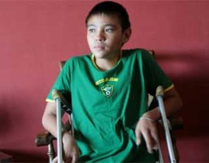 Болезнь Пертеса Болезнь Пертеса у детей