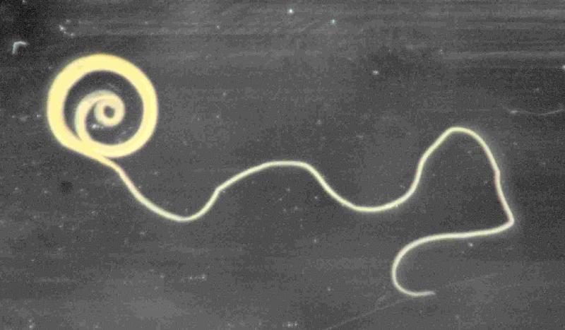 Симптомы и причины гельминтоза, диагностика и профилактика заболевания