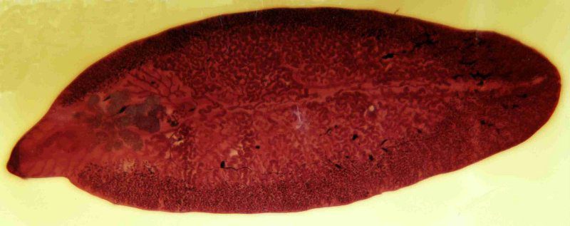 Печёночный сосальщик