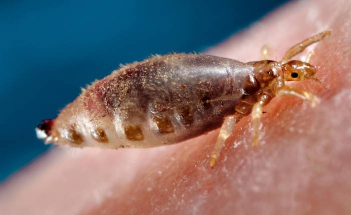 Платяная вошь