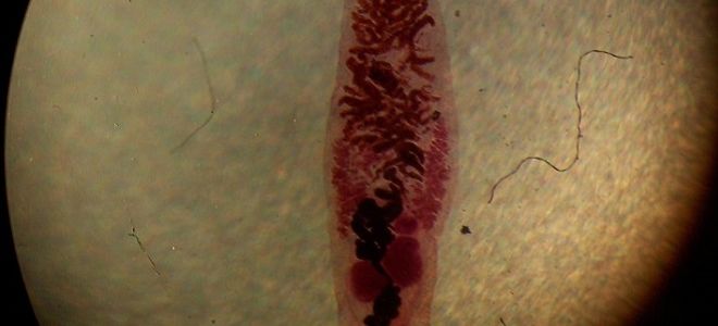 Пути передачи описторхоза