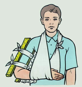 Перелом руки Самыми частыми видами переломов являются переломы конечностей