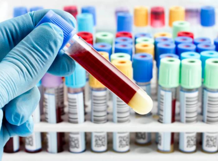 анализ крови