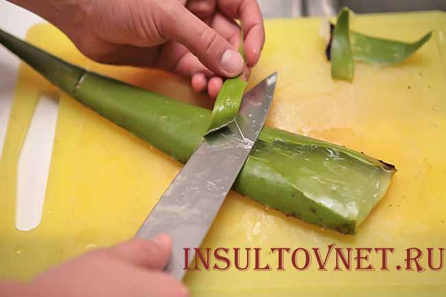 Лечение листьями алоэ