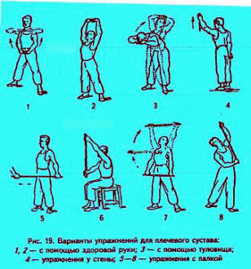 ЛФК заключительный этап реабилитации после вывиха плеча Упражнения после вывиха плечевого сустава