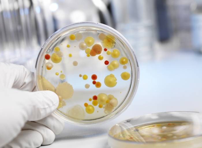 бактериальный посев