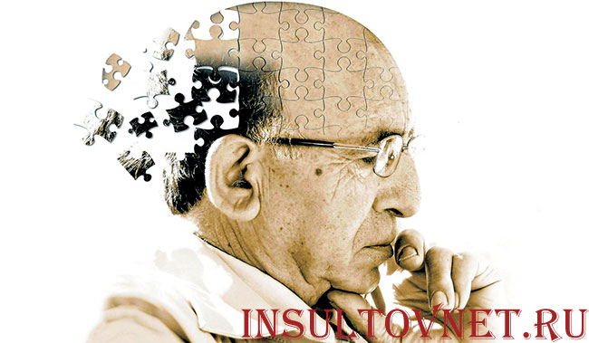 дегенерация мозга