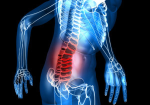 Боль в спине в пояснице Болезнь Кальве