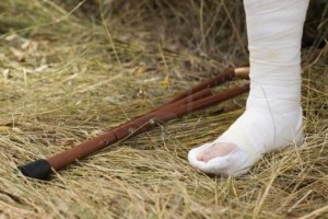 Нога в гипсе Программу восстановления конечности должен назначать доктор