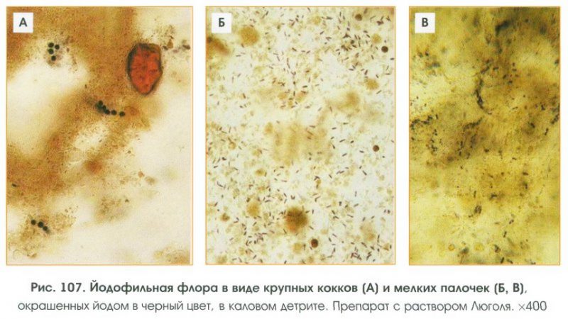 йодофильная флора