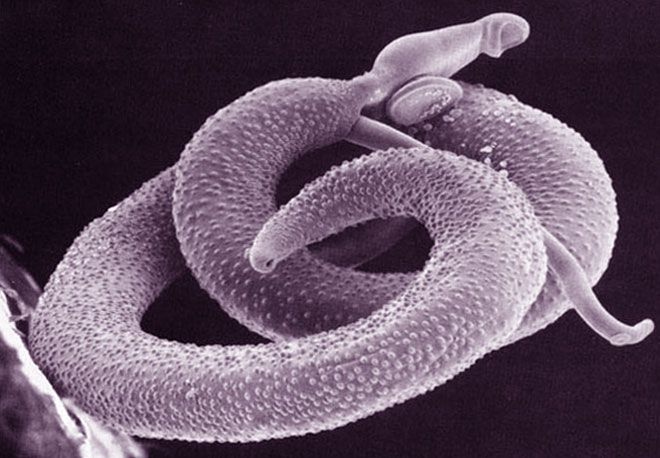 симптомы власоглава