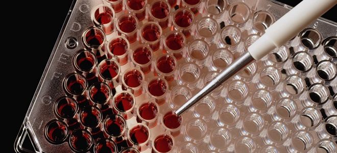 Анализ ИФА для определения антител к аскаридам