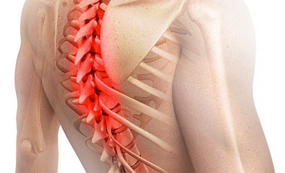 Как проявляется грыжа грудного отдела позвоночника и как её лечить