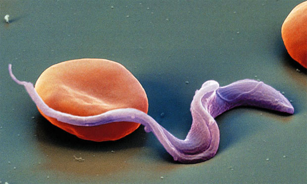 разновидности токсопламоза