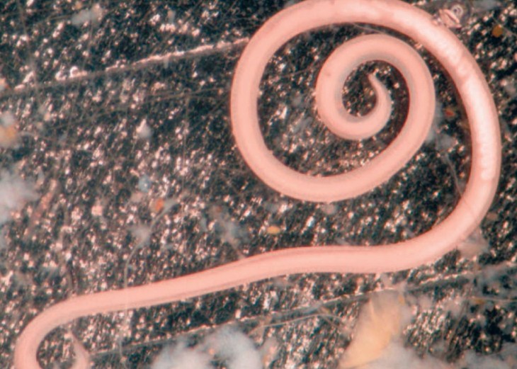 гельминтоз