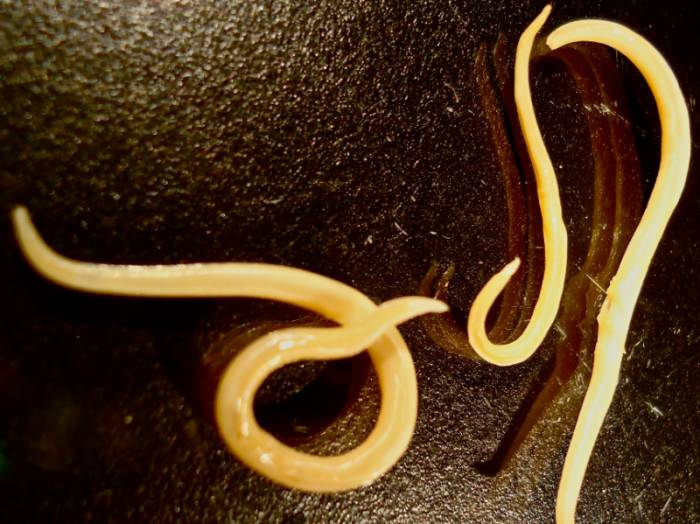 Аскарида у человека