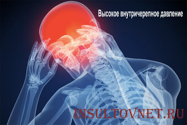 Высокое внутричерепное давление
