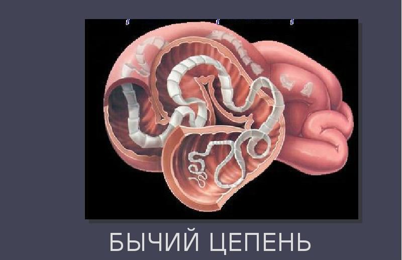 Бычий цепень