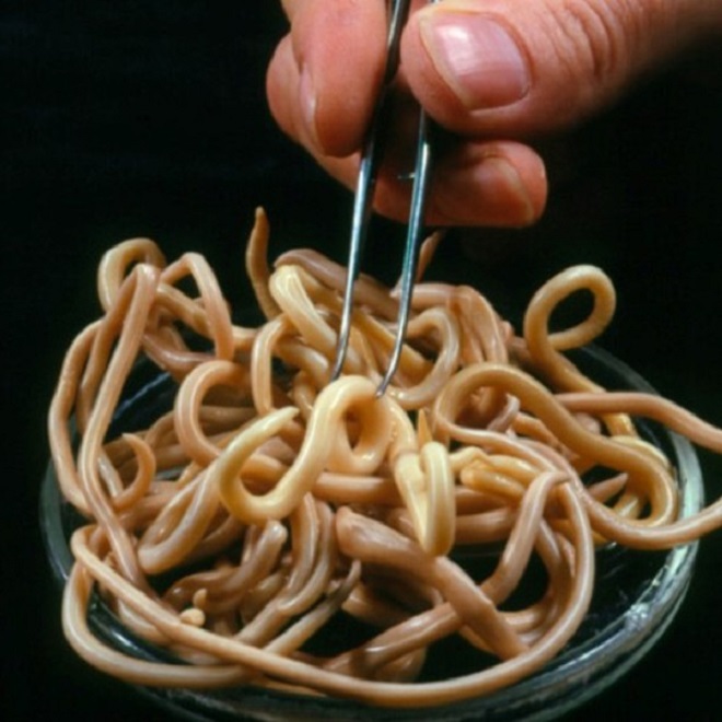 Как выглядят гельминты