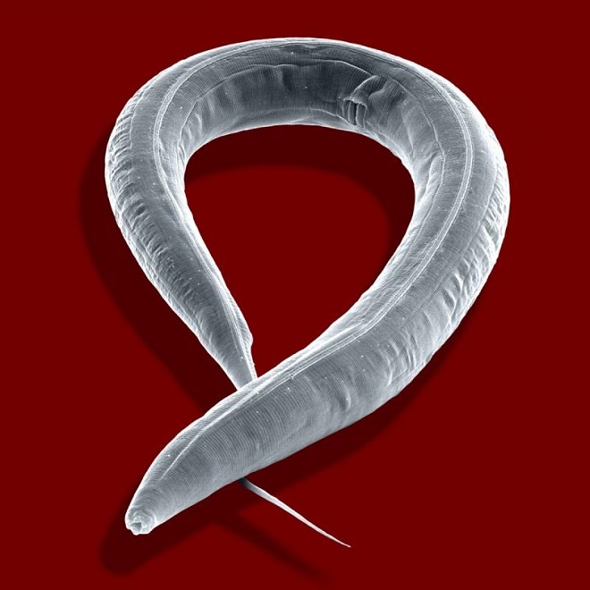 Как выглядит острица у детей