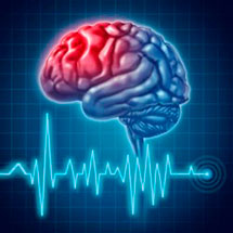 Прогноз инсульта