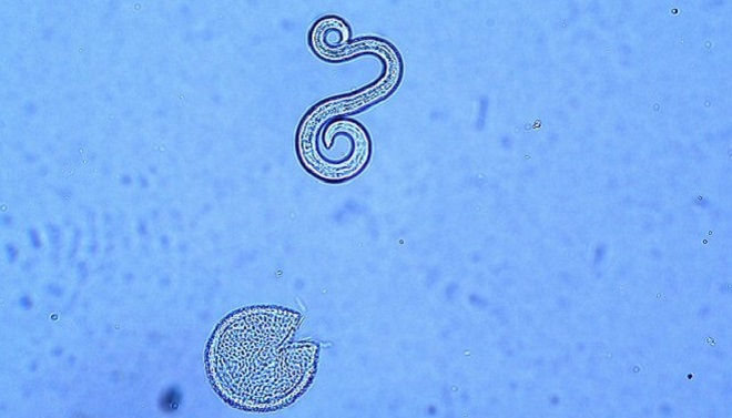 Токсокароз