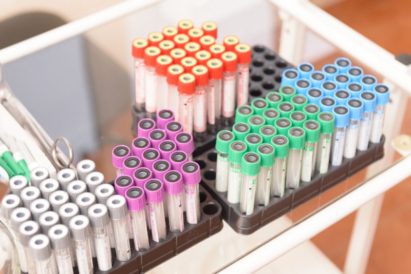 анализ крови и мочи