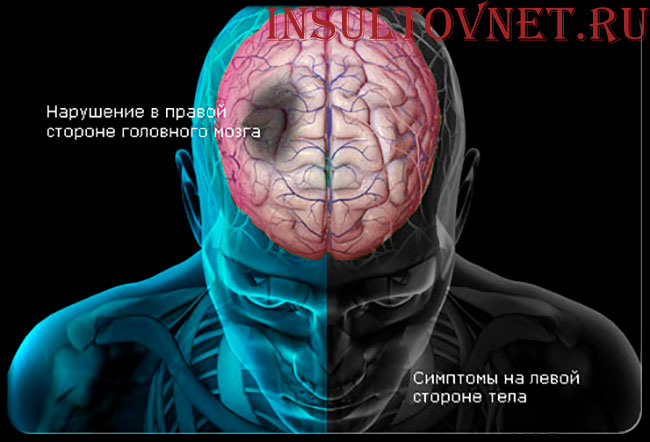 сторона поражения