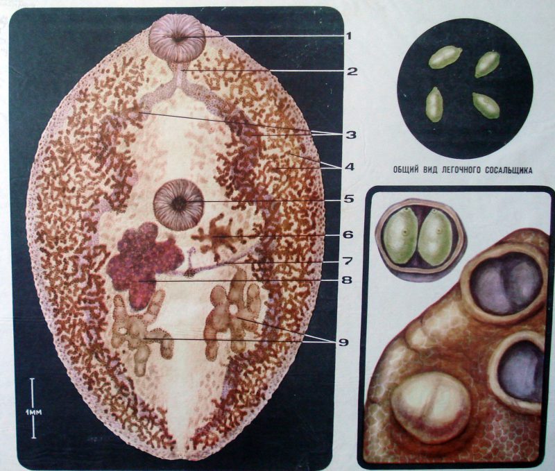 печеночная трематода
