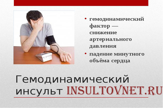 Гемодинамический инсульт