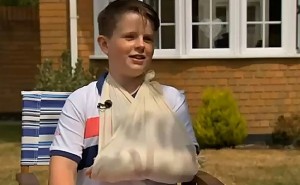 Перелом левой руки Травматический тип перелома считается самым распространенным