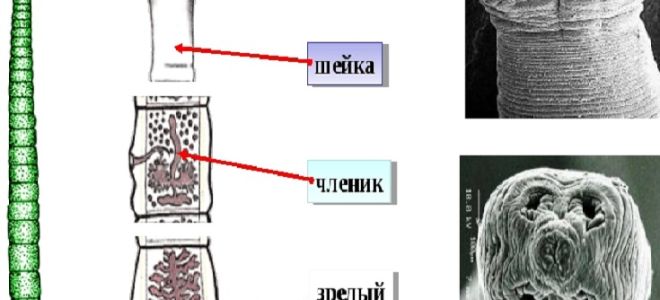Источники заражения бычьим цепнем