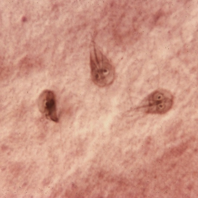 Как выглядят лямблии