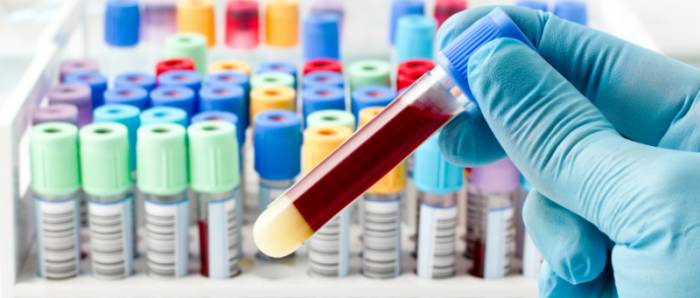 исследование анализов