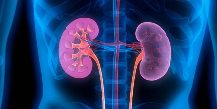 пиелонефрит