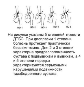 Степени тяжести ДТБС 5 степеней тяжести ДТБС