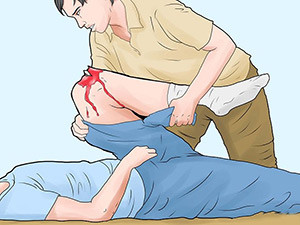 Оказание помощи пострадавшему Оказать первую помощь нужно быстро