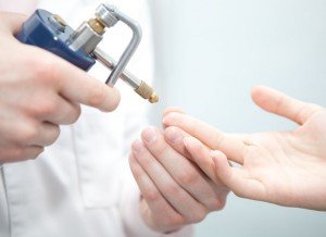 Удаление бородавок жидкий азотом