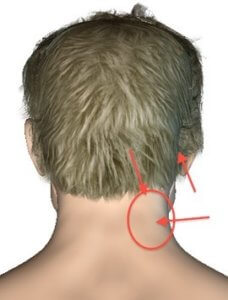 Что делать при боли в шее